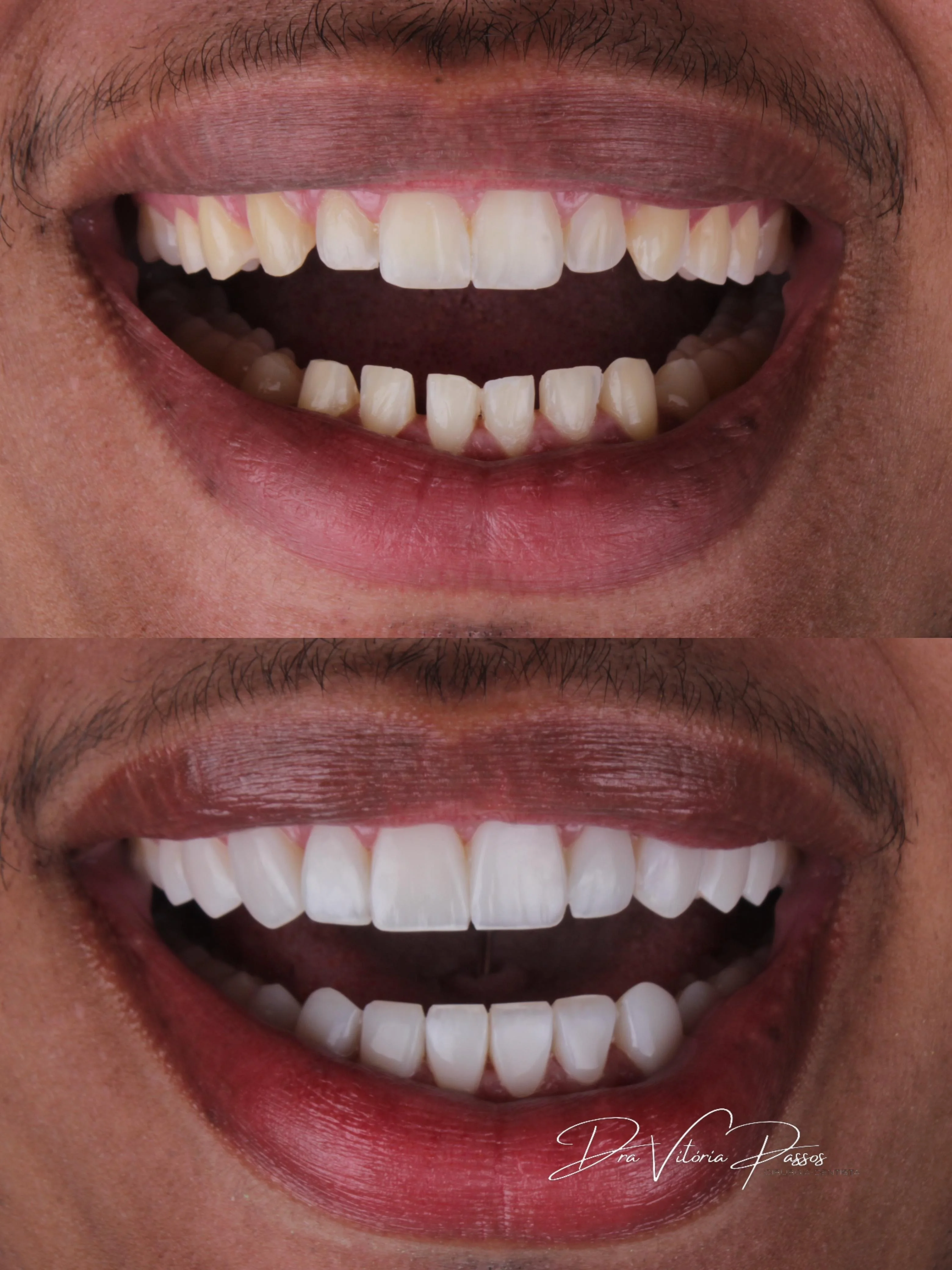 Antes e depois com transformação de cor, forma e alinhamento visual.
